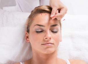 Edmonton Acupuncture
