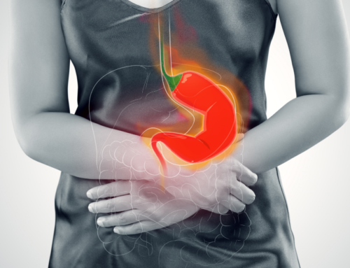 A Natural Approach to Acid Reflux