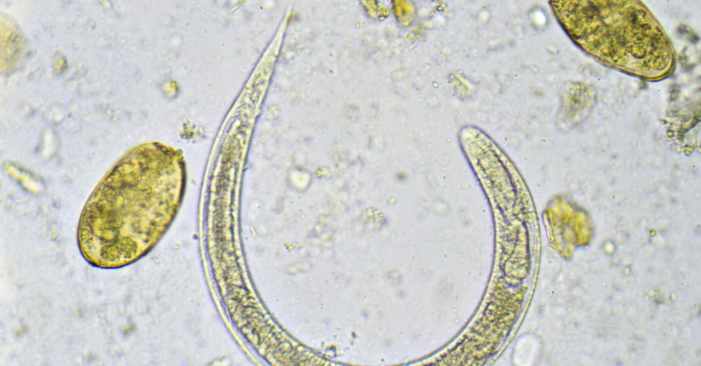 Parasite holistic treatment